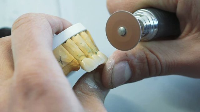 Closeup of grinding teeth crowns with instruments in dental lab