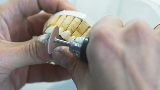 Closeup of grinding teeth crowns with instruments in dental lab
