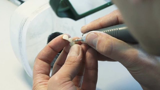 Closeup of making teeth crowns in dental lab