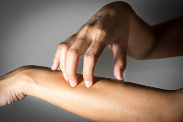 Woman scratching forearm skin.
