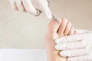 Rolgordijnen Hands in gloves cares foot nails. Pedicure beauty salon. Foot fingernails cutting with scissors. © fotoduets