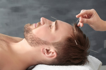 Young man getting acupuncture treatment, closeup - obrazy, fototapety, plakaty