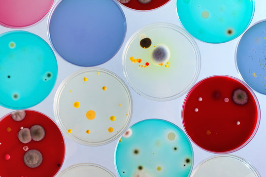 petri dishes in the lab / Growth plates in the laboratory 