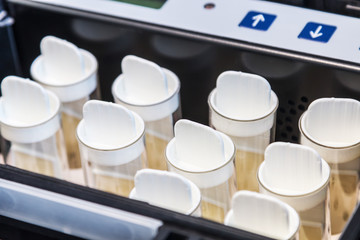 Medical device for measurements in the laboratory. Modern technologies in medical equipment