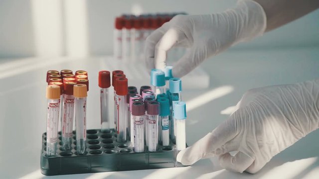 Hands of a lab technician with a tube of blood sample and a rack with other samples lab technician holding blood tube sample for study. Closeup of a scientist working with samples in lab.