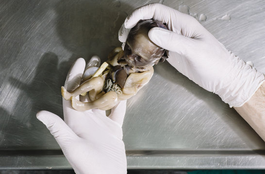 Hands with fetus wet specimen