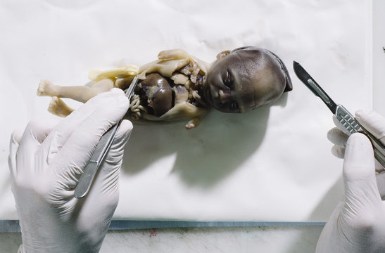 Medic preparing a fetus