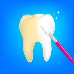 Tooth whitening. Brush over tooth, illustration. Dental care concept.