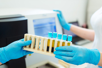 Hands of laboratory assistant loading sample tubes for coagulation test analysis and inputing data to coagulation machine