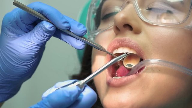 Dentist is using water syringe. Person wearing dental safety glasses.