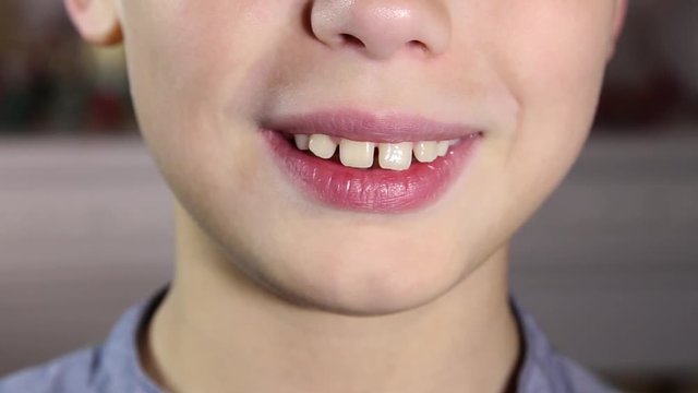 Closeup portrait of happy cute child showing his milk tooth after loosing it. Boy smiles and holds his tooth in hand. Real time full hd video footage.