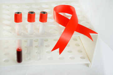Blood sampling and analysis in a biochemical laboratory on a light background.