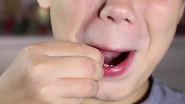 Child pulls his milk tooth away and shows it to camera. Closeup of open mouth of little kid. Real time full hd video footage.