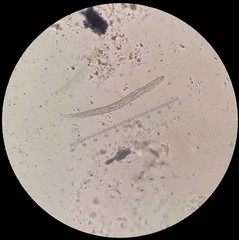 Parasite in stool under 40X light microscopy; Strongyloides stercoralis is a human pathogenic...