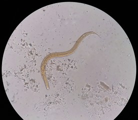 Parasite in stool under 40X light microscopy; Strongyloides stercoralis is a human pathogenic...