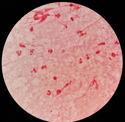 Smear of sputum specimen Gram's stained under 100X light microscope.