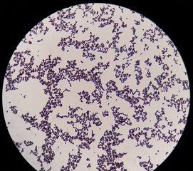 Smear of gram positive cocci bacteria under 100X light microscope.