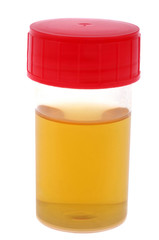 Flacon d'urine pour analyse sur fond blanc