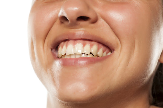 young smiling woman with beautiful teeth