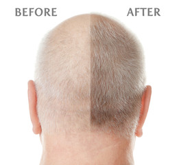 Bald senior man on white background