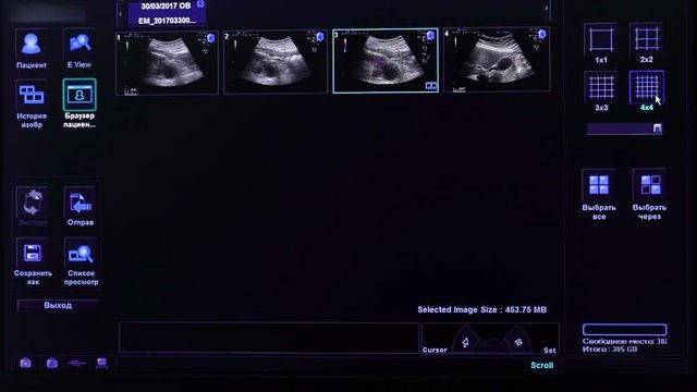 Display of electronic device for ultrasonography with the images of human internal organs. Pictures of different views of part of the body under examination in medical clinic.