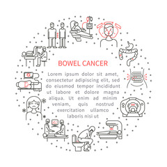 Bowel cancer illustration