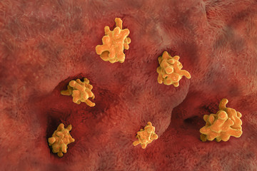 Entamoeba histolytica protozoan invading intestine. Parasite which causes amoebic dysentery and ulcers. 3D illustration