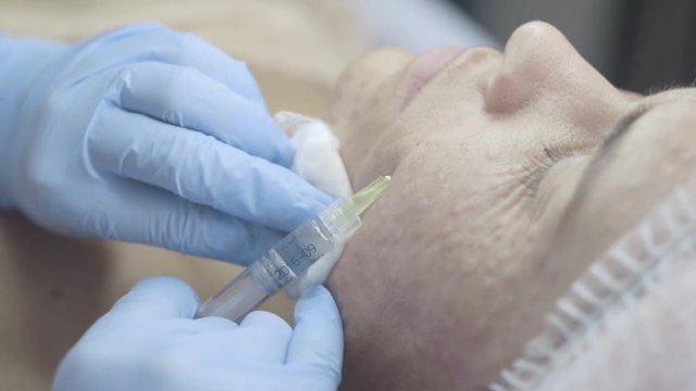 Close-up of a woman having botox injection in the beauty salon, anti-wrinkle treatment
