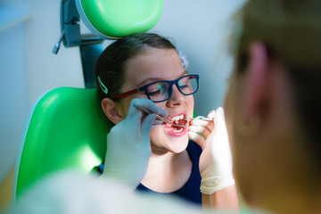 Close up of girl having his teeth examined by a dentist - dental caries prevention