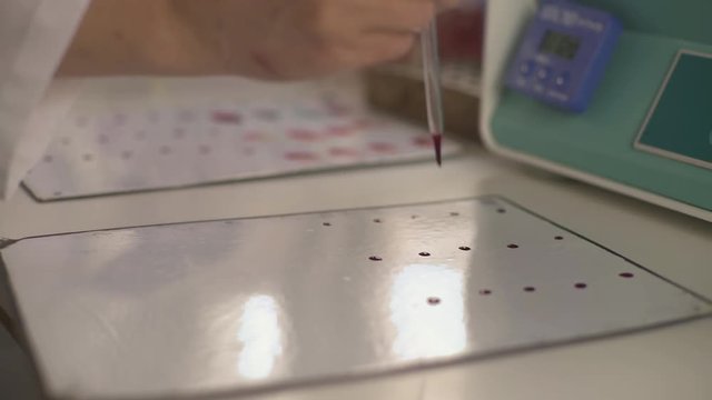 Hands close up of laboratory technician while dripping blood with pipette to determinates blood groups on the white plate, shallow depth of field, dolly shot