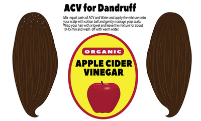 ACV for dandruff