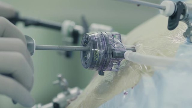 Laparoscopic surgery of the abdomen