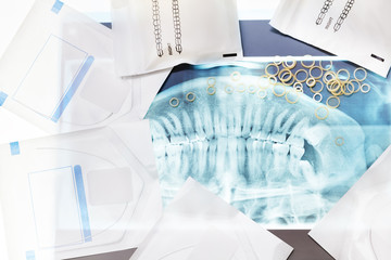 Many dental accessories for braces treatment  