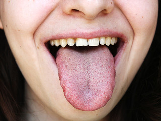 Attractive girl showing a healthy tongue
