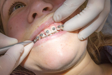 chez le dentiste