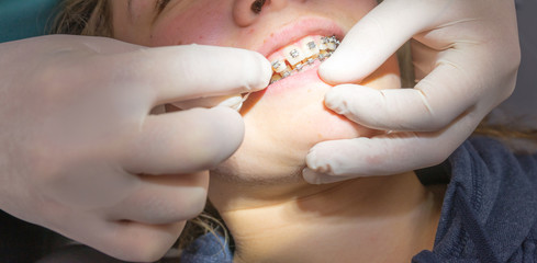 chez le dentiste