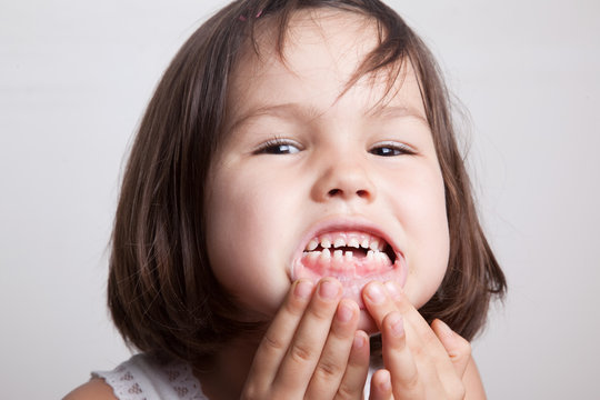 The Child Dropped The First Milk Tooth