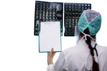 Doctor holding a picture of a brain MRI