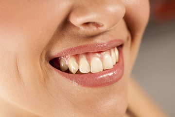 young smiling woman with beautiful teeth