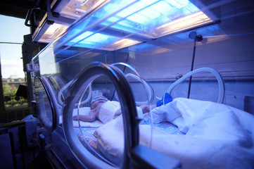 Newborn child baby having a treatment for jaundice under ultraviolet light in incubator. A neonatal intensive care unit (NICU), intensive care nursery (ICN) for premature newborn infants - obrazy, fototapety, plakaty