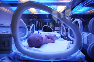 Newborn child baby having a treatment for jaundice under ultraviolet light in incubator. A neonatal...