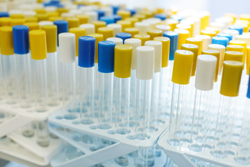 Medical test tubes close-up