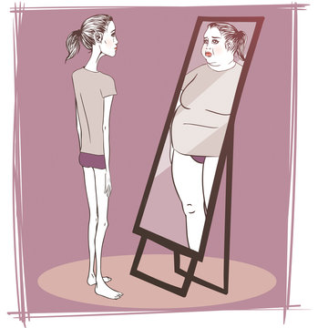 Young woman suffering from anorexia