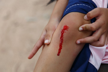 Knee wound on children