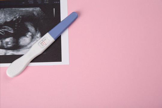 Ultrasound photo and pregnancy test on pink background