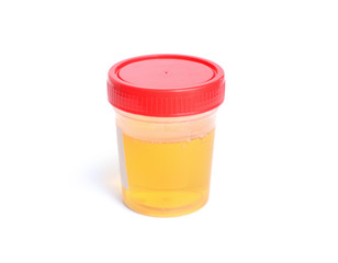 Container with urine for analysis. Isolated..