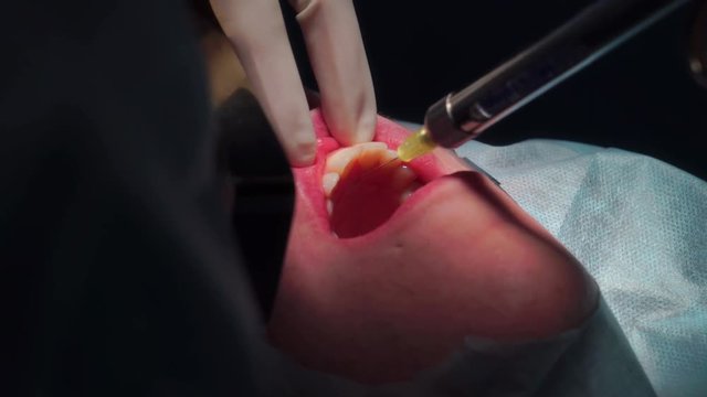 Anesthesia, Maxillofacial Surgery
