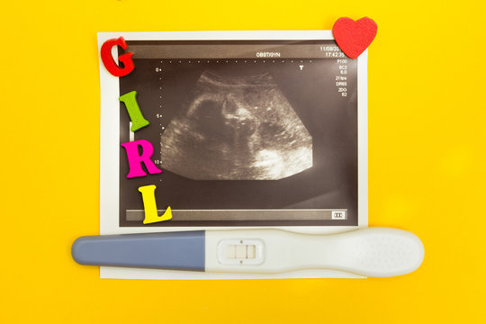 Positive pregnancy test, ultrasound photography, red heart and the word "girl" on a yellow background.