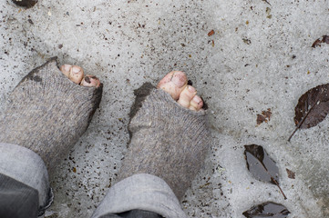 Bare Feet On The Snow