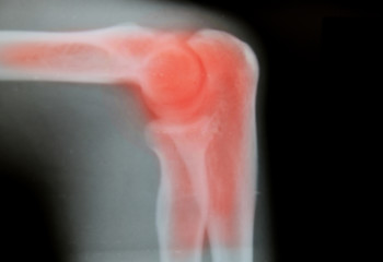 Close up Thigh bone